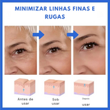 SkinLift™ Sérum Facial Botox