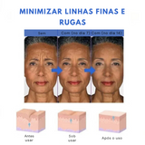 SkinLift™ Sérum Facial Botox